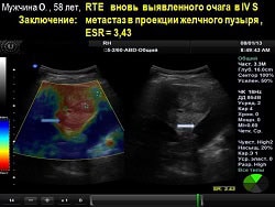 hirurgia4.jpg hirurgia4.jpg